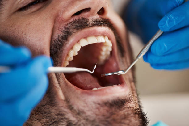 Best Emergency Dental Care for Abscessed Tooth in Phelan, CA